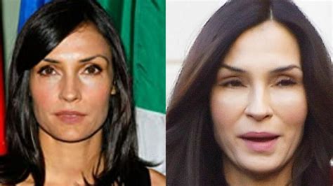 Actress Famke Janssen Plastic Surgery Rumors .